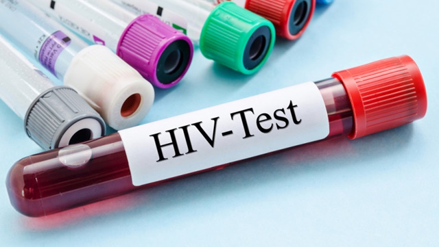 După 15 ani, Guvernul a aprobat, la propunerea Ministerului Sanatatii, o noua Strategie Nationala pentru supravegherea, controlul si prevenirea cazurilor de HIV/SIDA